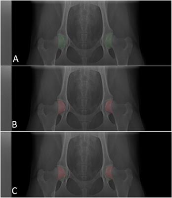 Active learning for data efficient semantic segmentation of canine bones in radiographs